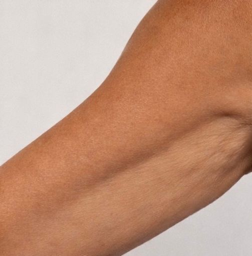 Upper-Arm Firmness Reference after